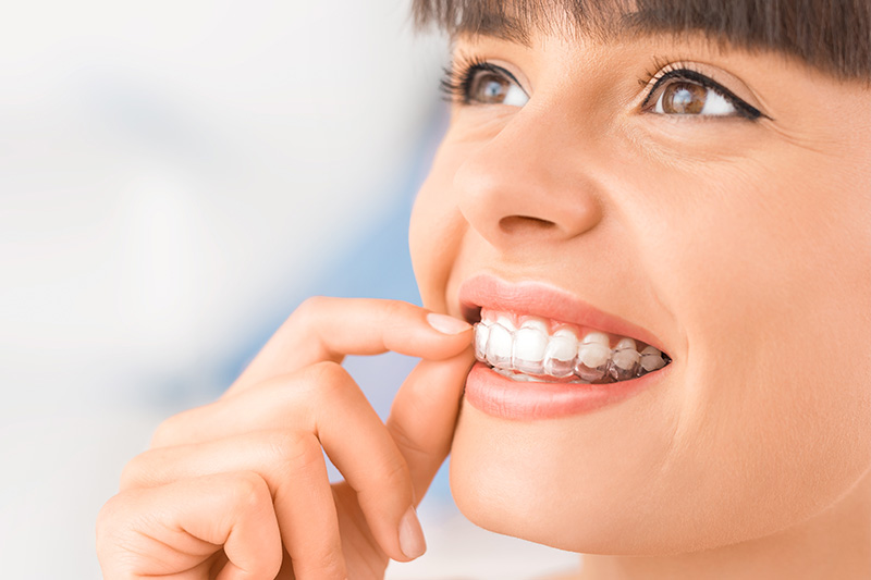 Invisalign in North Richland Hills