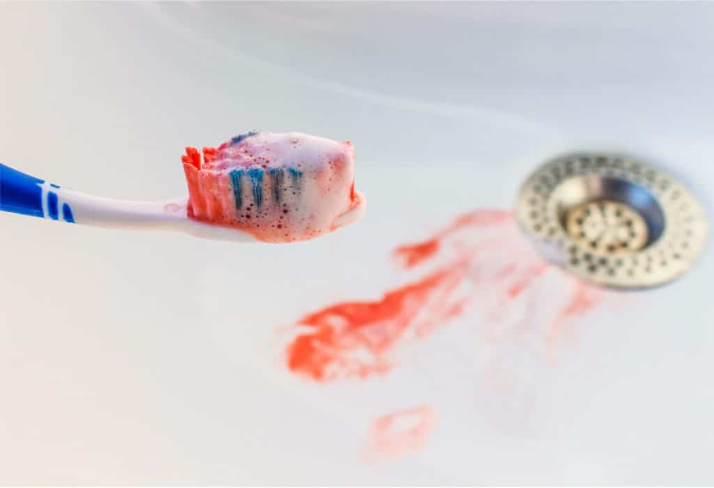 toothbrush head with blood from bloody gums