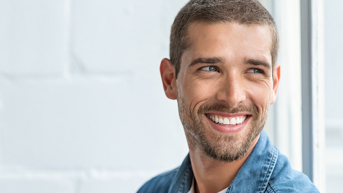 Man Smiling with Veneers